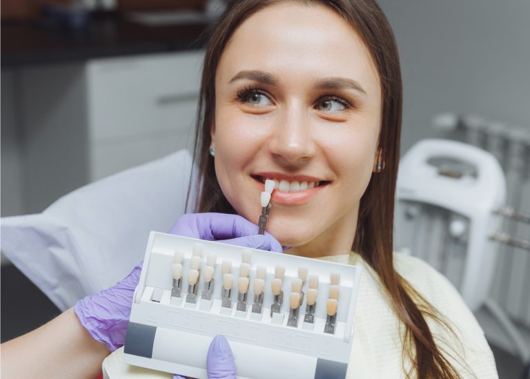 Discover the advantages of dental veneers